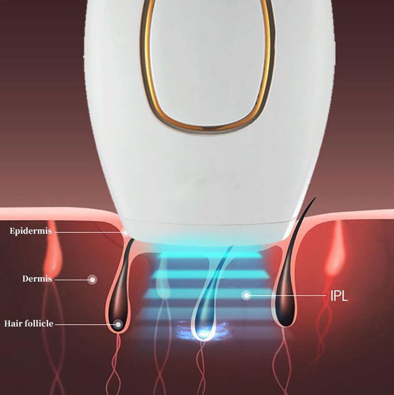 Depilador a Laser Definitivo Importado/LaserDepil Buzz